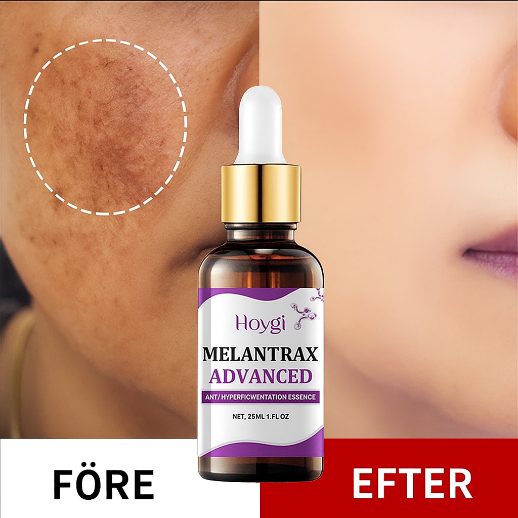 Hoygi Melantrax Anti - Hyperpigmentation Essence